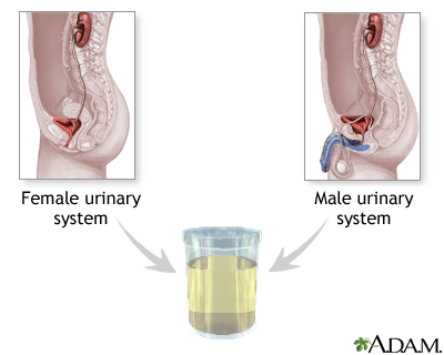 Urine sample