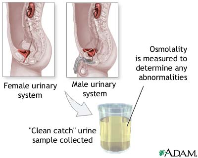 Osmolality test