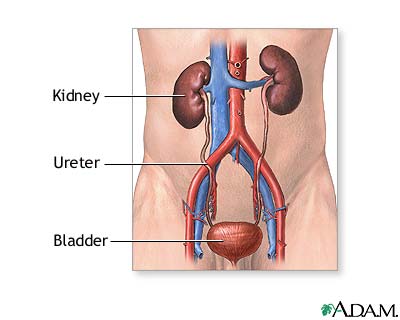 Kidney transplant - series