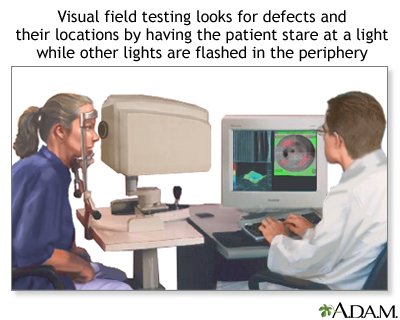 Visual field test