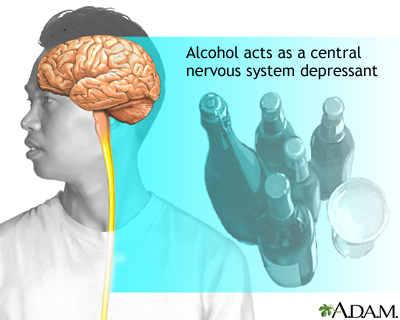 Alcohol use disorder