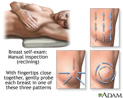 Breast self-exam