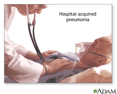Hospital-acquired pneumonia