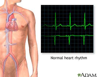 Normal heart rhythm