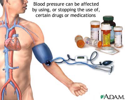 Drug induced hypertension