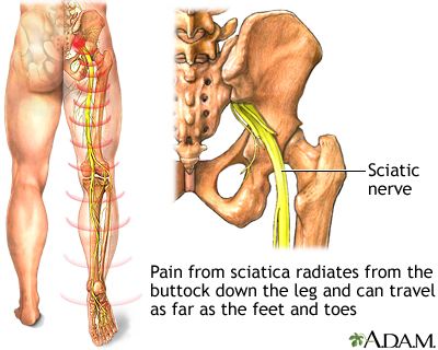 Healing from Herniated Disc: Effective Exercises For Herniated Disc in Lower  Back - Mainstay Medical