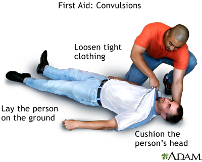 Convulsions - first aid - series