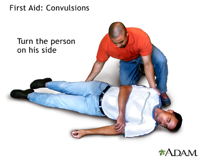 First aid convulsions, part 2