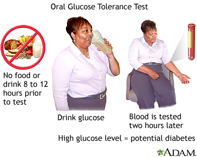 Oral glucose tolerance test