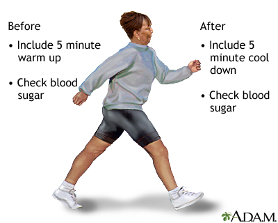 Diabetes and exercise