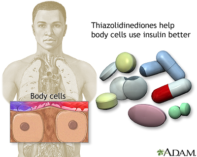 Thiazolidinediones