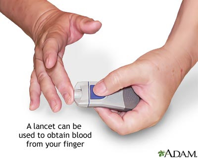 Monitoring blood glucose - Prick your finger