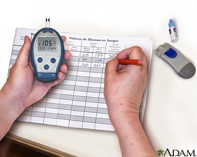Monitoring blood glucose - Record your reading