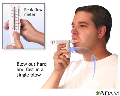 How to measure peak flow
