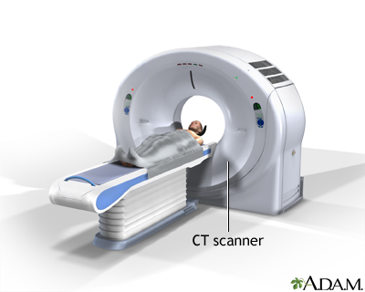 CT scan