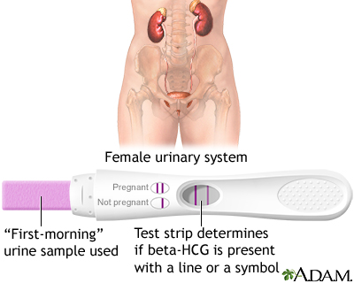 Pregnancy test