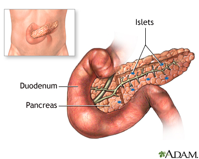 Pancreas transplant - series