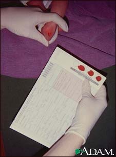 Newborn screening testing