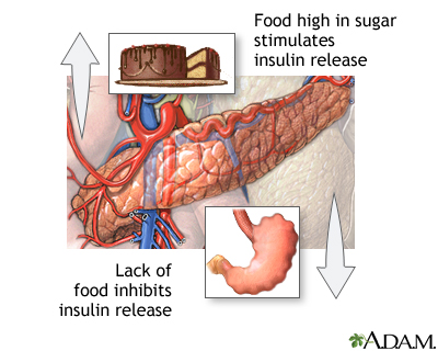 Coma diabetes mellitus különbségek