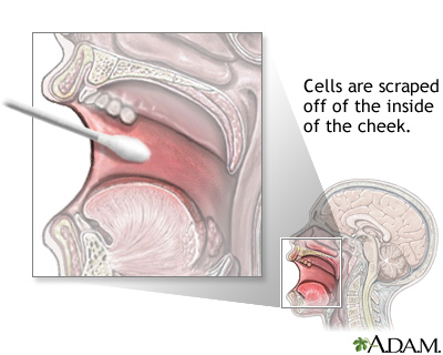 Buccal smear - illustration