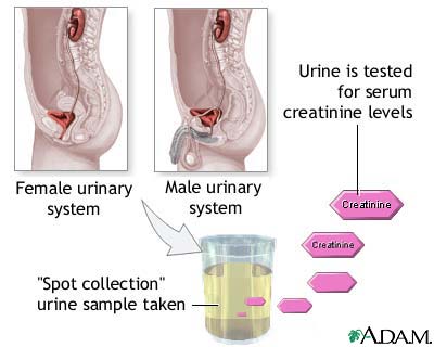 Creatinine urine test