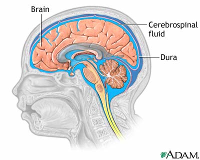 Cerebrospinal fluid leak
