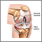 Knee joint replacement - Normal anatomy