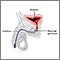 Inflatable artificial sphincter - series - Normal anatomy