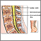 Lumbar spinal surgery - Series