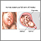 Vaginal birth - series - normal anatomy