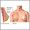 Breast augmentation - series - Normal anatomy