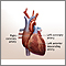 Heart bypass surgery - series - Normal anatomy